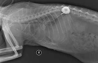 Radiografías postquirúrgicas que muestran la colocación de un puerto pleural 